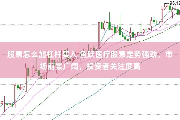 股票怎么加杠杆买入 鱼跃医疗股票走势强劲，市场前景广阔，投资者关注度高